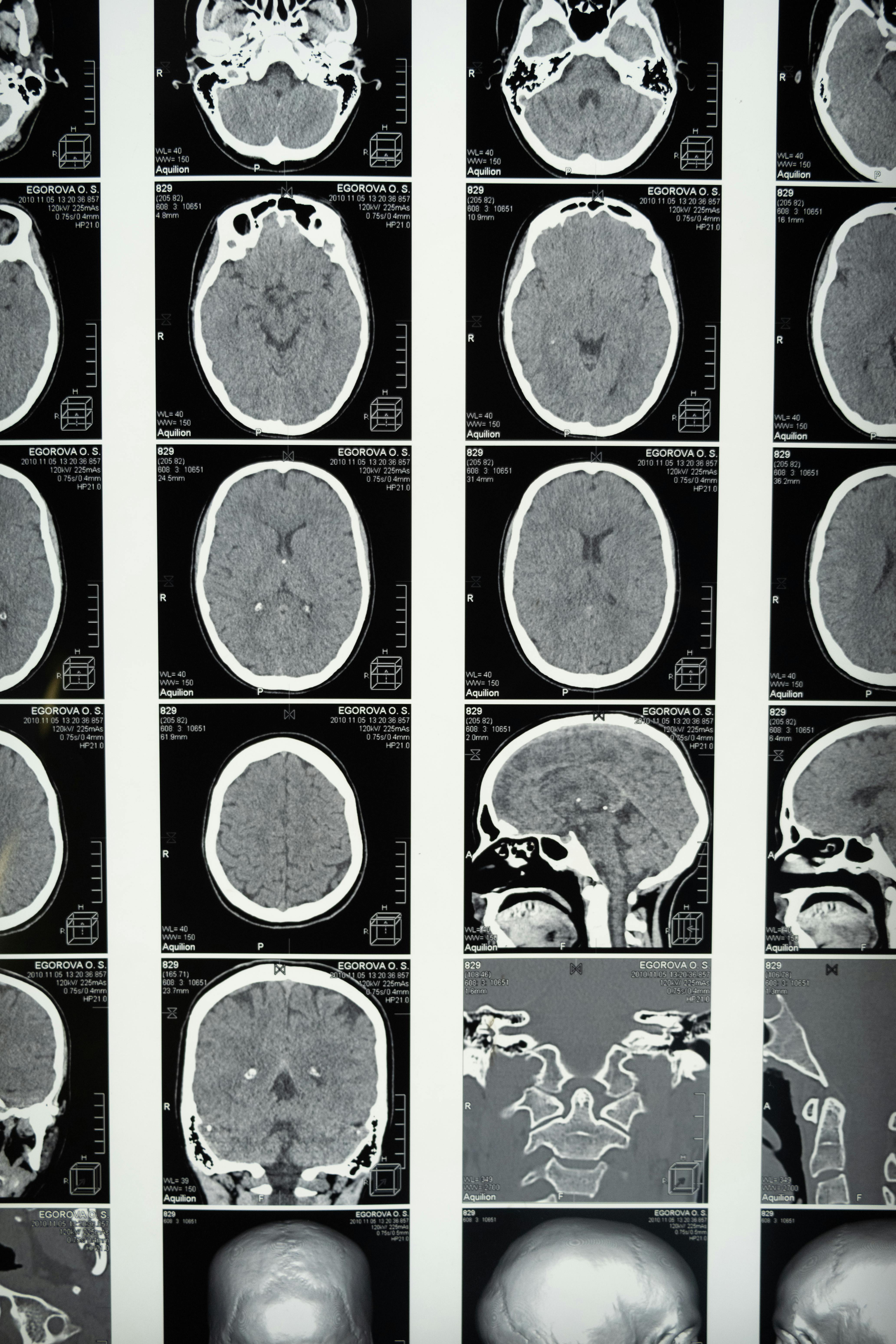Mastering Stress: Biohacks to Build Mental Resilience
